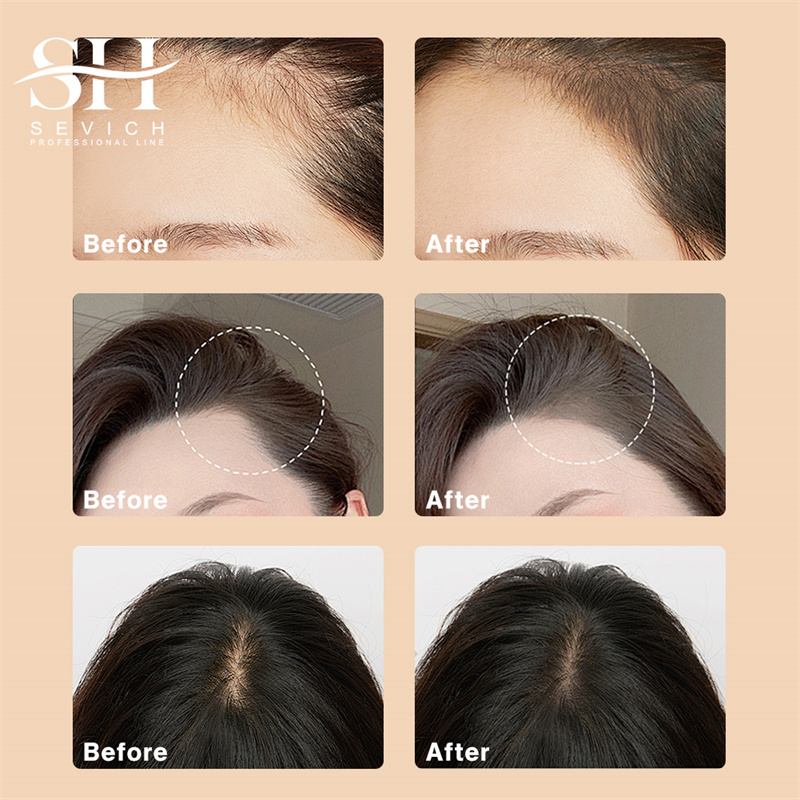 Linea sottile Ombra in polvere - Rooting Hormone Powder recensione e prezzo